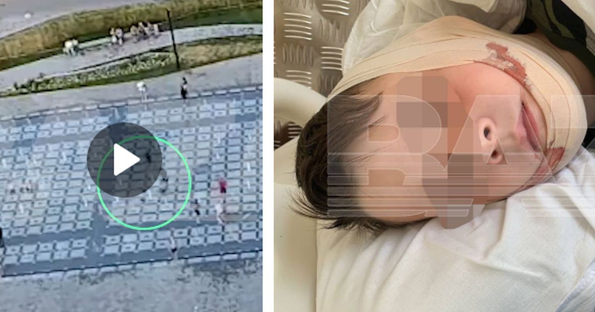 Петербург: полицейский на электросамокате сбил ребенка (а вовсе не наоборот)