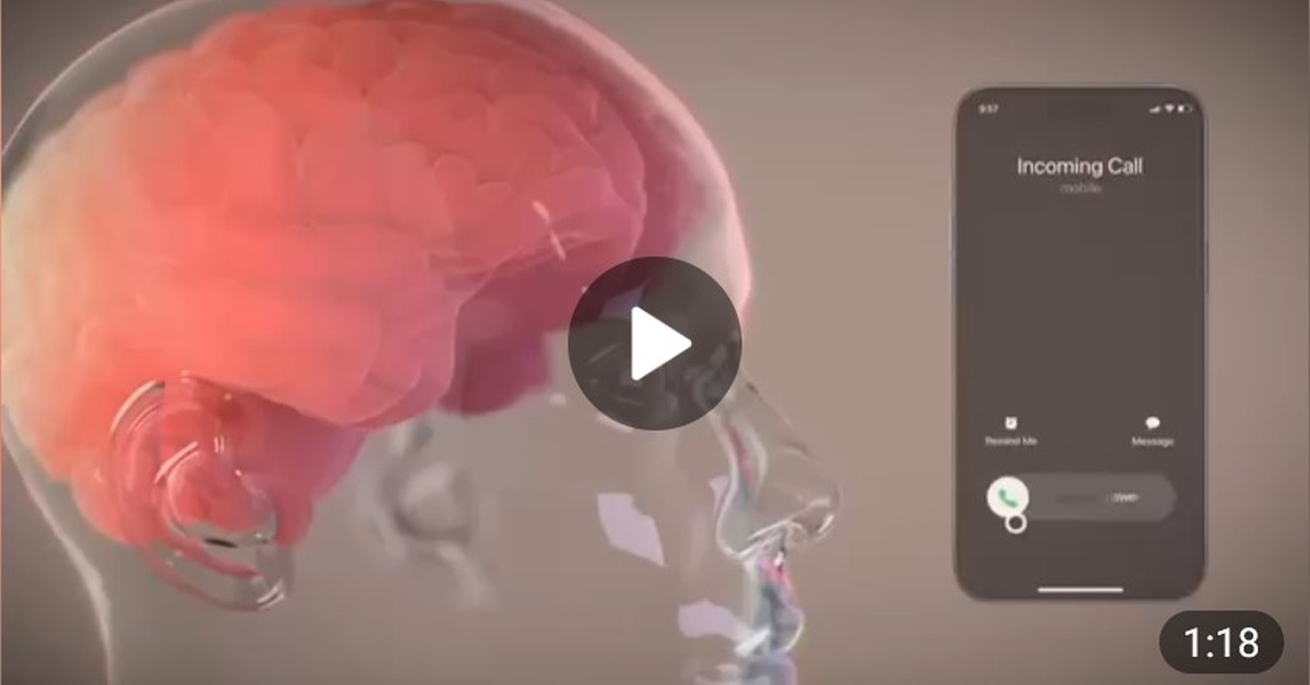 Neuralink в действии: первый пациент научился управляться с головным чипом