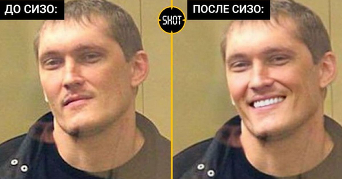 Дошли руки заняться зубами: 18-кратный убийца вставил себе виниры за 800 тыс, сидя в СИЗО