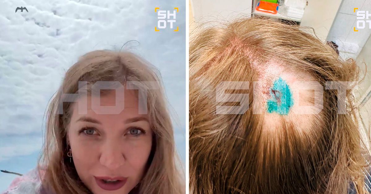 Агрессивная чайка со всей дури клюнула затылок туристки на Сахалине