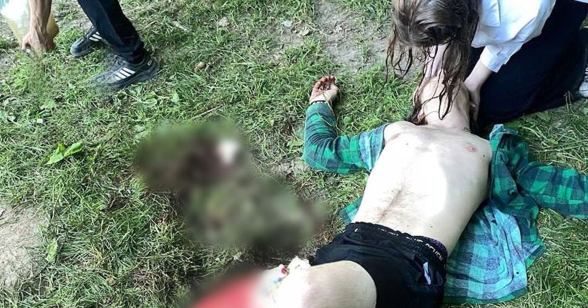 Ножом по ноге: пьяный извращенец изрезал подростка в Нижнем Новгороде