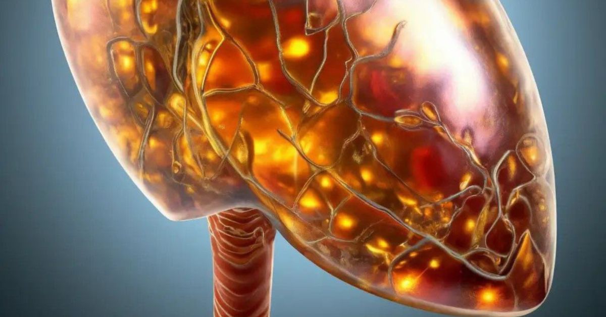 Читаем диагноз: жировой гепатоз 