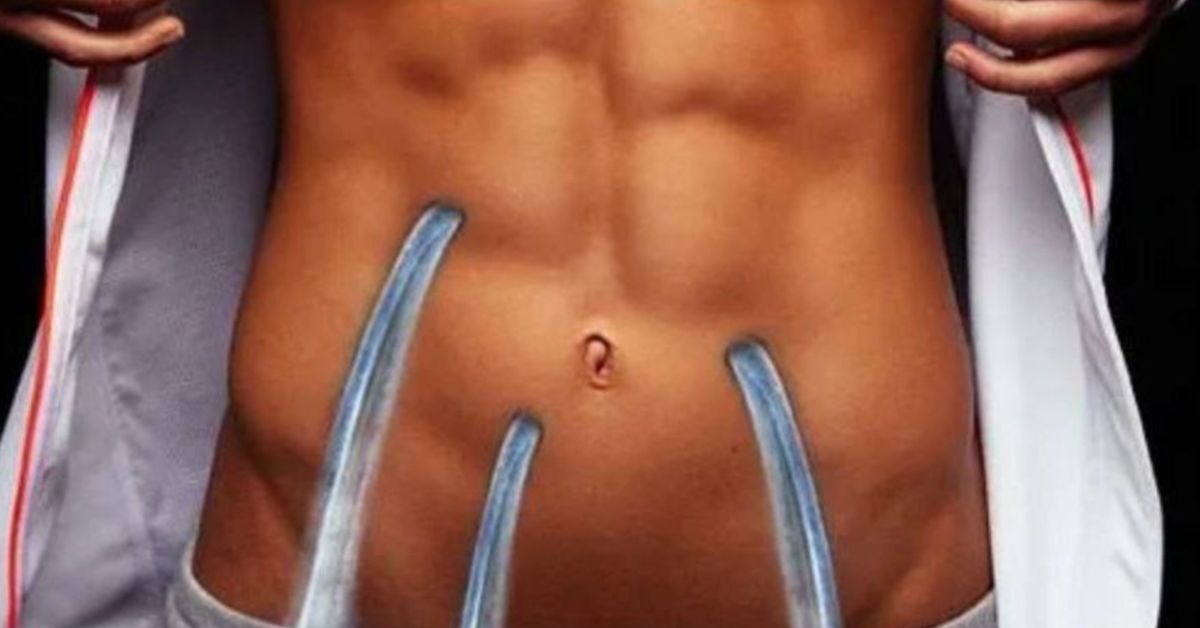 Бывает ли «дырявый кишечник»? И что это такое?