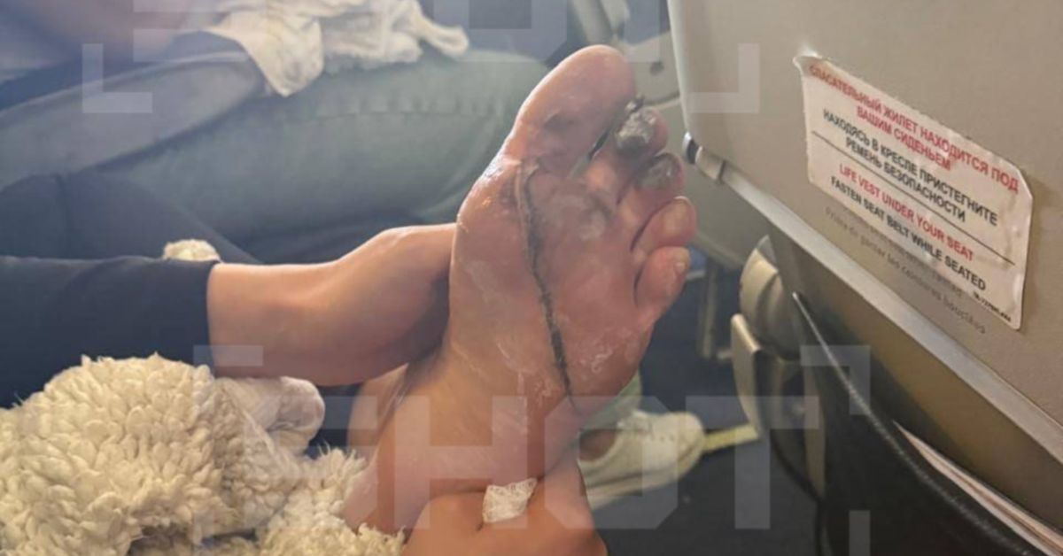 В самолете из Питера в Якутск взорвался пауэрбанк. Травмирована молодая мать В самолете из Питера в Якутск взорвался пауэрбанк. Травмирована молодая мать