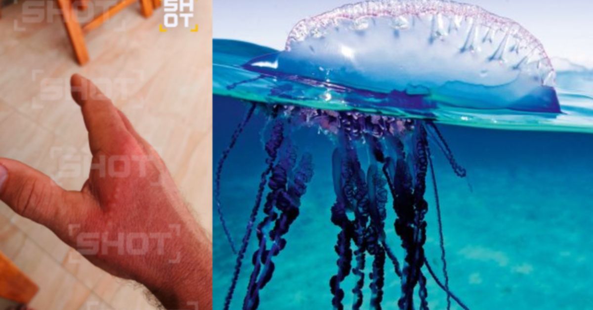 Россиянин спецоперирован португальским корабликом на Сейшелах Россиянин спецоперирован португальским корабликом на Сейшелах