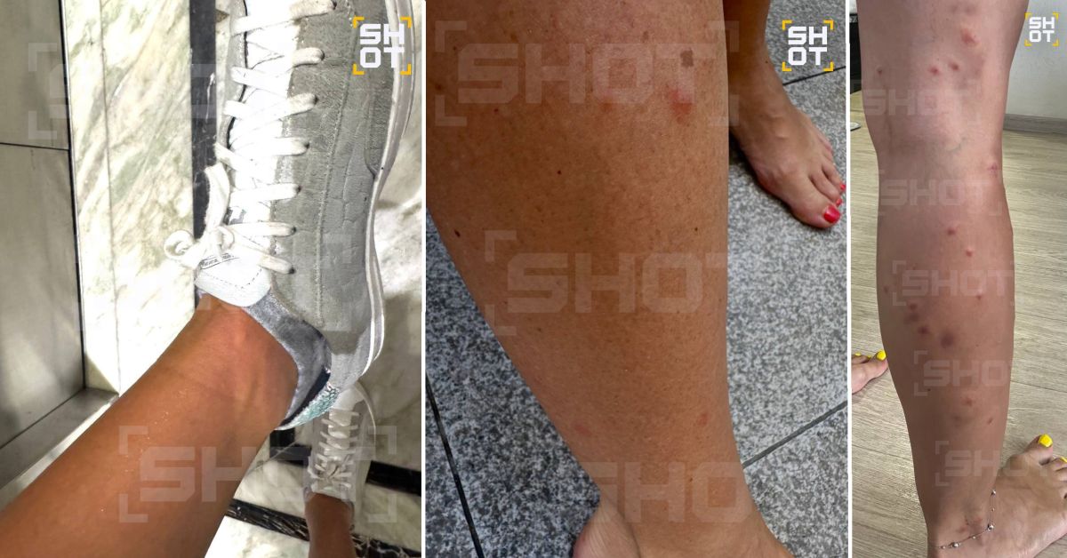 Российские туристы спецоперированы песчаными блохами на пляжах Китая