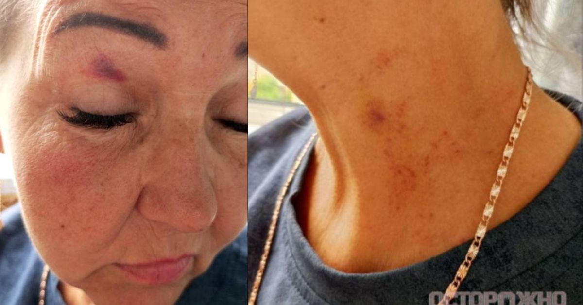 В тени СВО: сестра избила сестру в борьбе за «гробовые деньги»