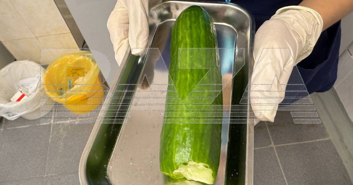 Ой, что это?! Огурец, застрявший в анальном отверстии дамочки из Уфы