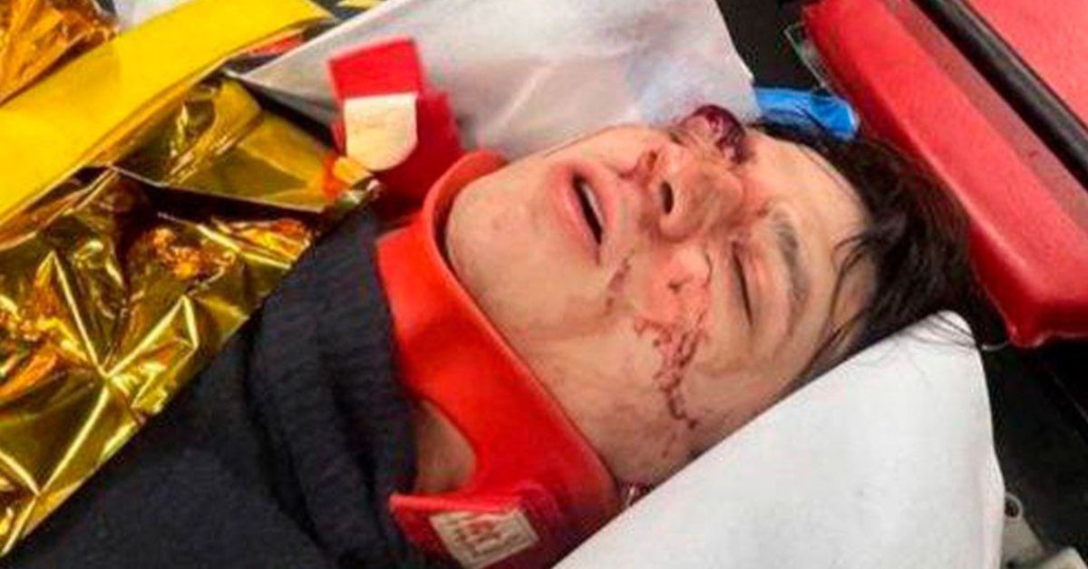 Ой, кто это?! Рэпер VACIO, пронзивший стеклянную крышу с третьего этажа