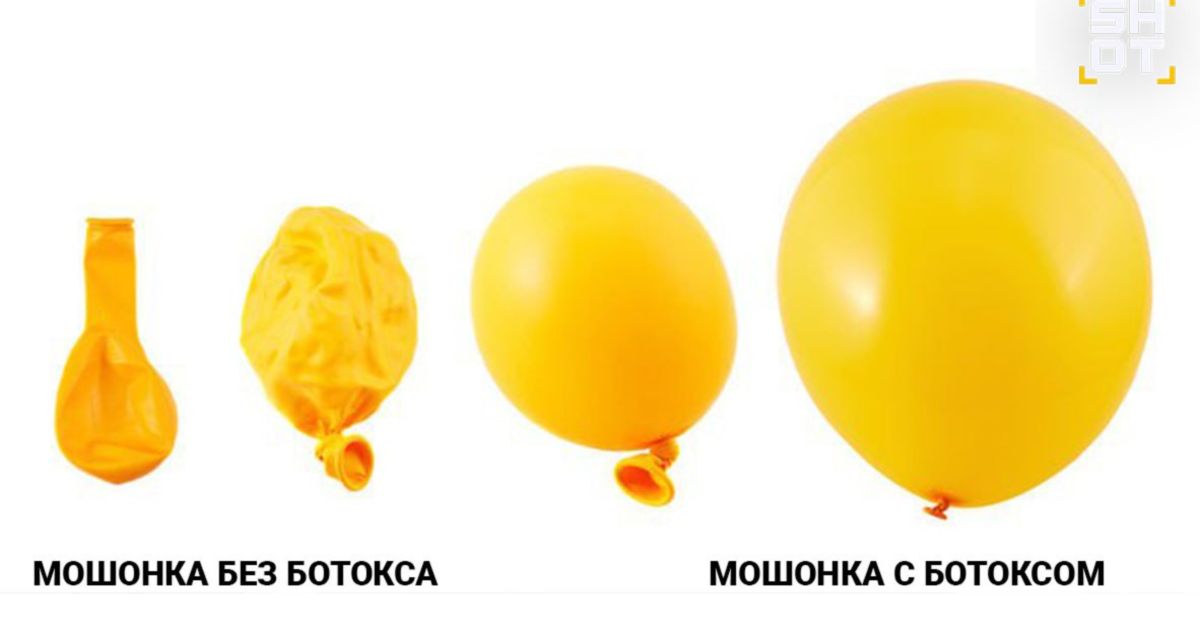 Красота мужской гордости: российские мужики (нет, не все) активно колют себе ботокс в яички