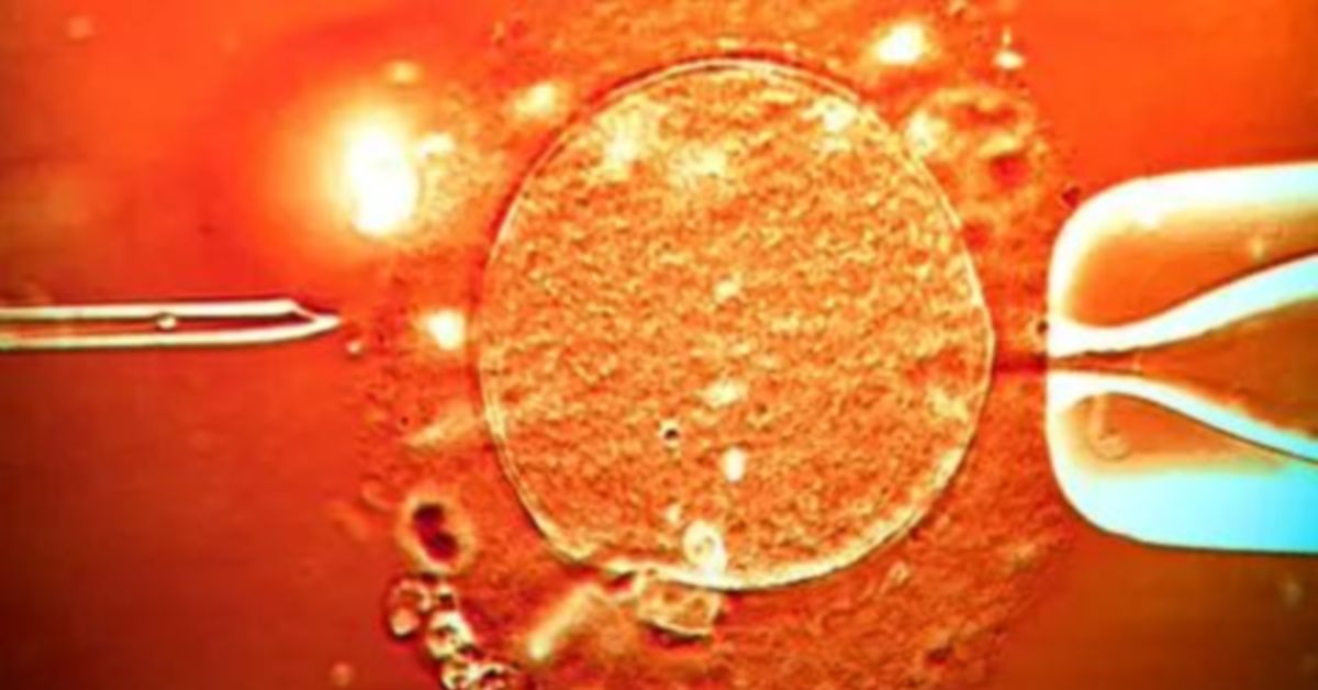 197 детей родилось в Европе от донора спермы с геном, вызывающим рак