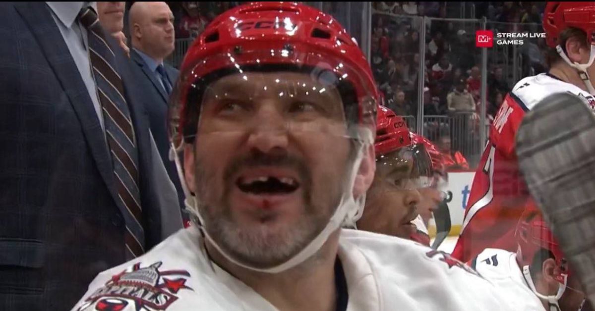 Ой, кто это?! Александр Овечкин с выбитым зубом!