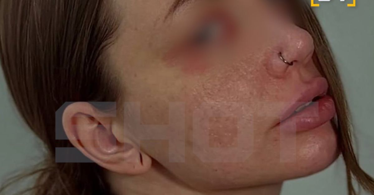 Москвичка чуть не померла от неправильных таблеток от депрессии