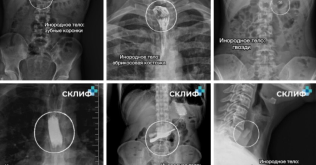 Ой, что это?! Всякие штучки, обнаруженные в человечках