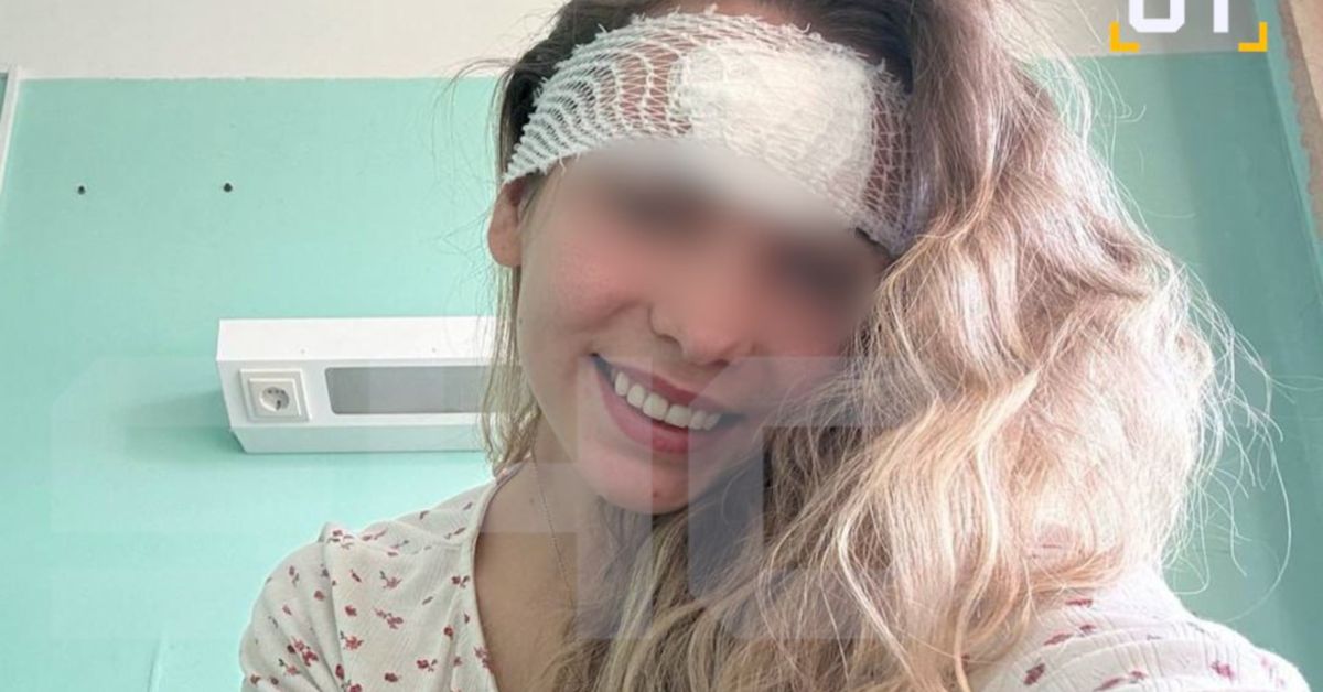 Ой, что это?! Последствия неудачно выдавленного прыщика на лбу